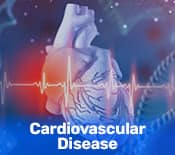 Cardiovascular Diseases 